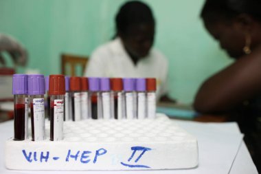 AIDS hastaları için tıp merkezi. Bedava gösterim. Togo. 