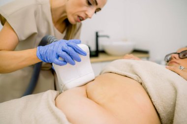 Güzellik kliniğindeki masada yatan tombul kadın ve ekin güzellik uzmanı kriyolipoliz yağ donma teknolojisini makineyle uyguluyorlar.