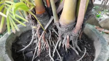 Kolesistektomi. Geleneksel Kuzey Hindistan yemeği, akşam yemeği, kahvaltı. Lezzetli Hint yemekleri..