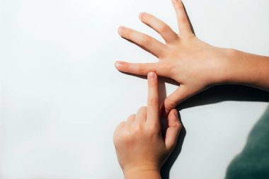Beyaz arka planda siğili olan çocuklar. Papilomavirus. Yukarıdan görüntüle
