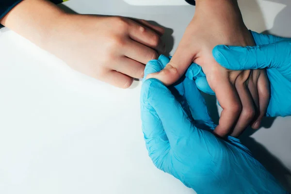 Childrens Hand Wart White Background Papilomavirus Top View — Stock Photo, Image
