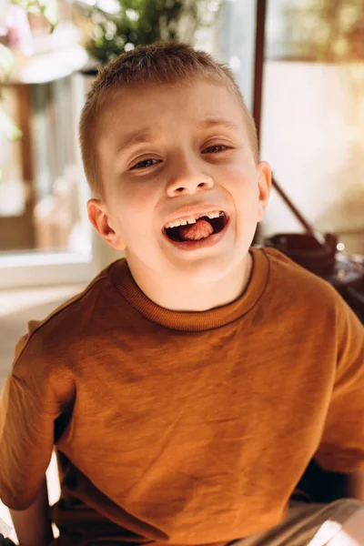 Chłopiec Wieku Szkolnym Pokazuje Zęby Które Rosną Utracie Zębów Mlecznych — Zdjęcie stockowe