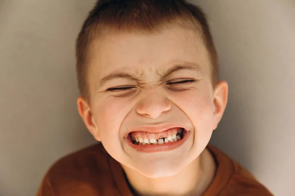 Menino Idade Escolar Mostra Dentes Que Crescem Após Perda Dentes — Fotografia de Stock