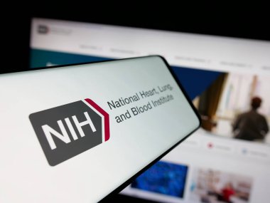 Stuttgart, Almanya - 05-25-2025: İnternet sitesi önünde ABD Sağlık Enstitüsü logosu bulunan akıllı telefon. Telefon ekranının merkez soluna odaklan.