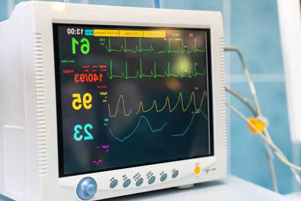 Modern Ekg Machine Hospital Emergency Room Used Heart Attack Diagnosis — Stock Photo, Image