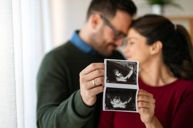Bebek ultrasonu olan mutlu hamile kadın kocasıyla kucaklaşıyor. Ebeveyn olmak için sabırsızlanan mutlu bir çift.