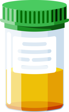 Caps 'li test tüpleri. Dışkı, kan, idrar ve sperm. Tıbbi teçhizat. Jinekolojik analiz için numune kapları. Laboratuvarda biyomateryal analizi yapılan plastik kaplar. Düz Vektör İllüstrasyonu