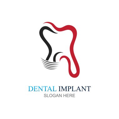 Diş implantı logo tasarım vektörü, Diş Bakımı logo şablonu