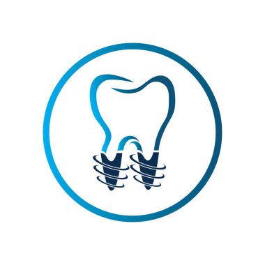 Diş implantı logosu ve sembol tasarım şablonu vektörü