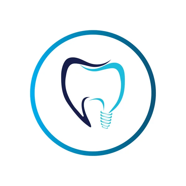 Vektor Des Zahnimplantat Logos Und Der Symboldesign Vorlage — Stockvektor