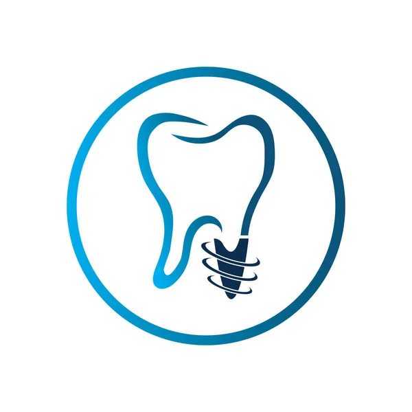 Vettore Del Logo Dell Impianto Dentale Modello Design Del Simbolo — Vettoriale Stock