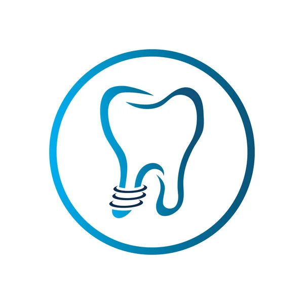 Vettore Del Logo Dell Impianto Dentale Modello Design Del Simbolo — Vettoriale Stock