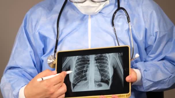 Doktor Tablette Göğüs Bölgesinin Röntgenini Gösteriyor — Stok video