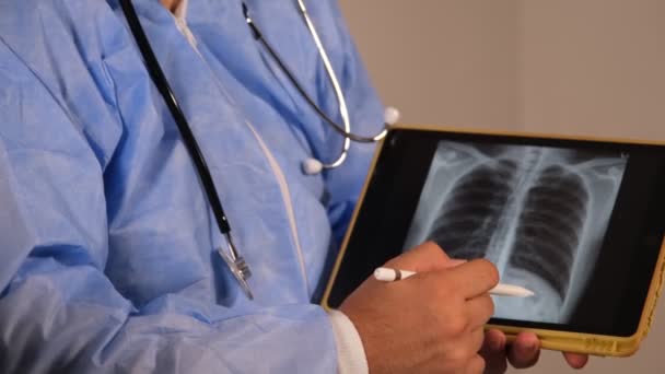Arzt Untersucht Lungen Röntgen — Stockvideo