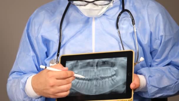 Zahnröntgen Arzt Zeigt Zahnröntgen Mit Tablette — Stockvideo