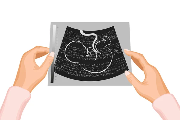 Fotografie Ultrazvuku Embrya Nenarozeného Dítěte Matčiných Rukou Ilustrace Vektor — Stockový vektor