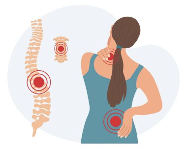 Servikal ve bel omurlarında ağrı olan bir kadın. Sırt ağrısı, kas ağrısı, osteoartrit, romatoid artrit. İlaçlar. Görüntü, vektör