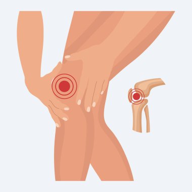 Diz ekleminde ağrı, diz eklem iltihabı, romatizmadan dolayı bacak ağrısı. İnsan kemiklerinin anatomisi. Görüntü, vektör