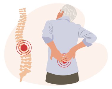 Omurgasında ağrı olan yaşlı bir adam. Sırt ağrısı, kas ağrısı, osteoartrit, romatoid artrit. İlaçlar. Görüntü, vektör