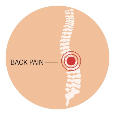 Sırt ağrısı, omurilik ağrısı, osteoartrit, romatoid artrit. İnsan kemiklerinin anatomisi. İlaçlar. Görüntü, vektör