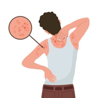 Alerjik kaşıntı, deri iltihabı, kızarıklık ve tahriş. Dermatit, egzama, sedef. Sağlık ve ilaç servisi. Vektör