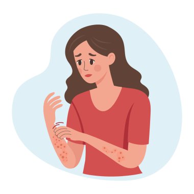 Kadın elini tırmalıyor. Alerjik kaşıntı, deri iltihabı, kızarıklık ve tahriş. Dermatit, egzama, sedef. Sağlık ve İlaç Hizmetleri.