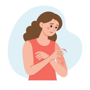 Kadın elini tırmalıyor. Alerjik kaşıntı, deri iltihabı, kızarıklık ve tahriş. Dermatit, egzama, sedef. Sağlık ve İlaç Hizmetleri.