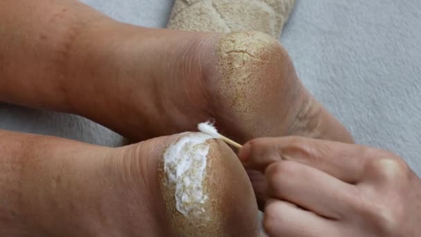 ヒールにクリームを塗る 女性の手の閉じるドライクラック肌と足のかかとに保湿栄養クリームを適用します 皮膚治療の概念 — ストック動画