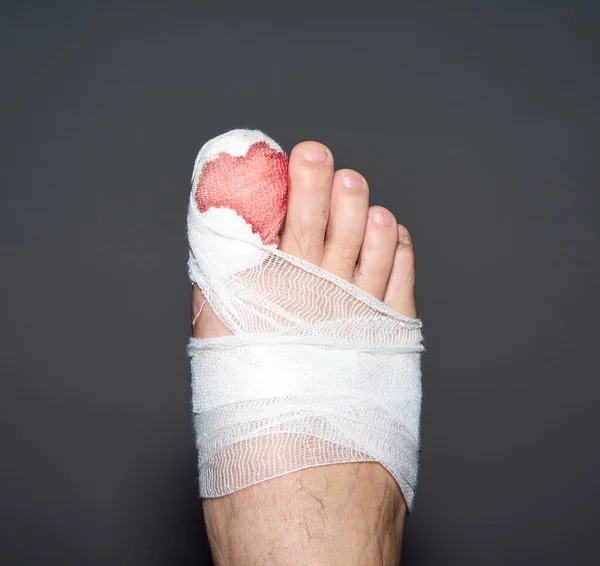 Нога Чоловіка Кров Перев Язаний Великий Палець Ізольовані Сірому Фоні — стокове фото
