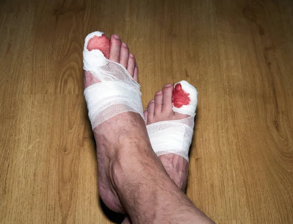床の上に大きなつま先を血で包帯をした男の足 — ストック写真