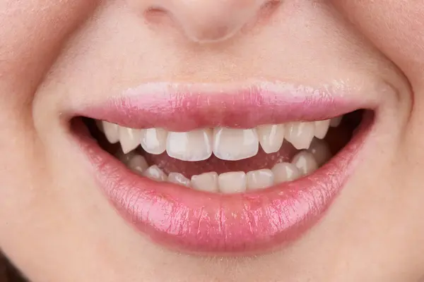 Macro Fotografia Dentes Com Lábios Bonitos Mostrando Folheados Imagem De Stock