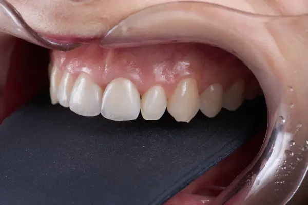 Fotografia Macro Dentes Com Folheados Imagens Royalty-Free