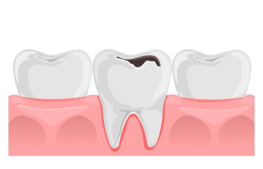 Sakızlı dişler. Diş anatomisi. Düz vektör çizimi beyaz arkaplanda izole edildi.