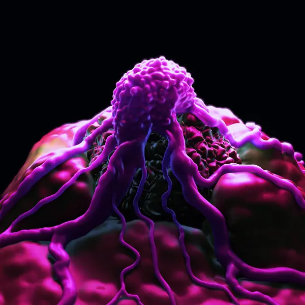Kanser hücreleri, kanser hücresinin elektron mikro grafiğini geliştirdi. Hücrenin yüzeyinin çok yüksek bir büyütmeyle görünümü. Tıbbi araştırma konsepti, kanser ya da tümör, 3D render