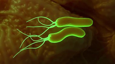 Helicobacter pylori bakterisi, gram-negatif, kırbaçlanmış, sarmal bir bakteridir. Mutantların çubukları ya da kavisli çubukları daha az öldürücü olabilir.