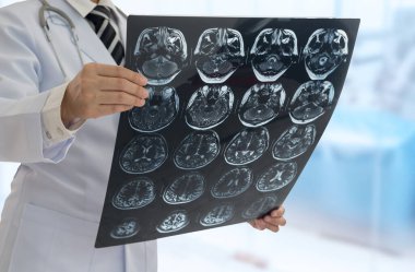 Doktor, hastanedeki ameliyathanede beyin hastasının röntgen görüntüsünü teşhis etti. tıbbi beyin konsepti.