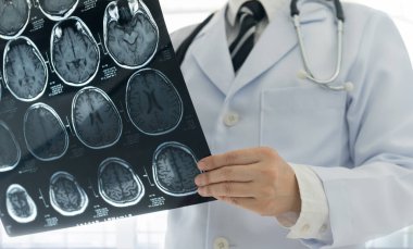 Doktor, hasta odasındaki hastanın beyin tomografisi ile beyin röntgenlerini kontrol et..