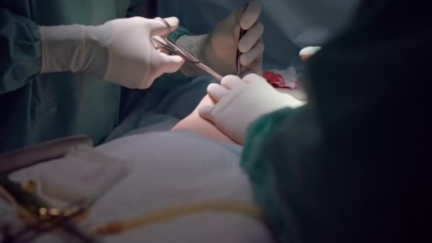 Nerozpoznatelný Chirurg Používající Chirurgické Kleště Nůžky Zpomaleném Pohybu Operačním Sále — Stock video