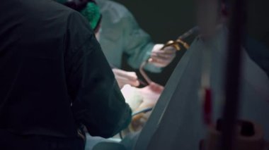 Arka plan implantı için ameliyat odasında bulanık cerrah kesiği olan bir hemşire var. Klinikte göğüs büyütme nakli ameliyatı. Yavaş çekim