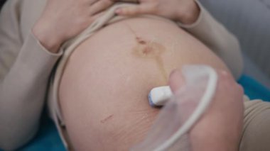 Yakın plan. Ultrason muayenesi sırasında karnı ağrıyan kadın. Ultrasonografi süreci. Doktor hamile kadınların karnındaki bebeği kontrol ediyor. Sonogram için modern teknoloji tıbbi ekipman