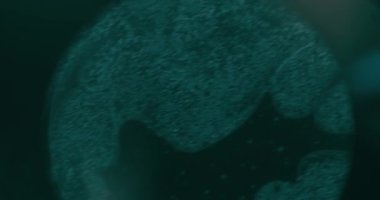 Laboratuvarda Kanser Hücrelerinin Mikroskop altında Kapanışı