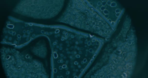 Gros Plan Des Cellules Cancéreuses Microscope Laboratoire — Video