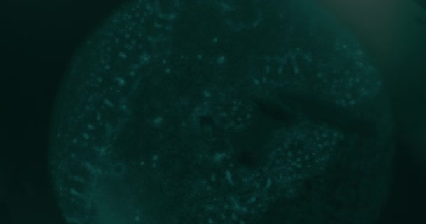 Primer Plano Las Células Cancerosas Bajo Microscopio Laboratorio — Vídeo de stock
