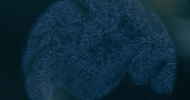 研究室での顕微鏡下でのがん細胞の閉鎖 — ストック動画