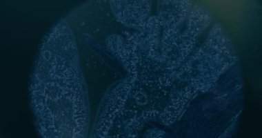 Laboratuvarda Kanser Hücrelerinin Mikroskop altında Kapanışı