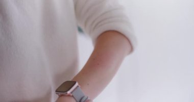 Küçük bir ısırıktan sonra kırmızı şişlik ve tahriş gösteren bir kadın eli.