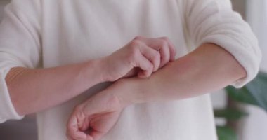 Kadın, şişmiş kolunun ön kısmında hafif bir ısırık izi bırakıyor, rahatlamak için.