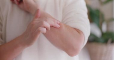Isırık belirtilerini azaltmak için şişmiş elleriyle merhem süren bir kadın.