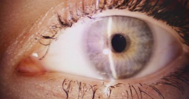 Profesyonel bir retina kontrolü sırasında bir kadının gözünün özel aletlerle incelenmesi aşırı derecede yakın plandır..