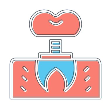 Dentistry implant icon outline vector. Dental tooth. 